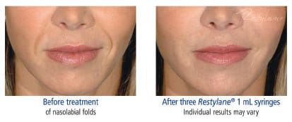 NJ Cosmetic Injections