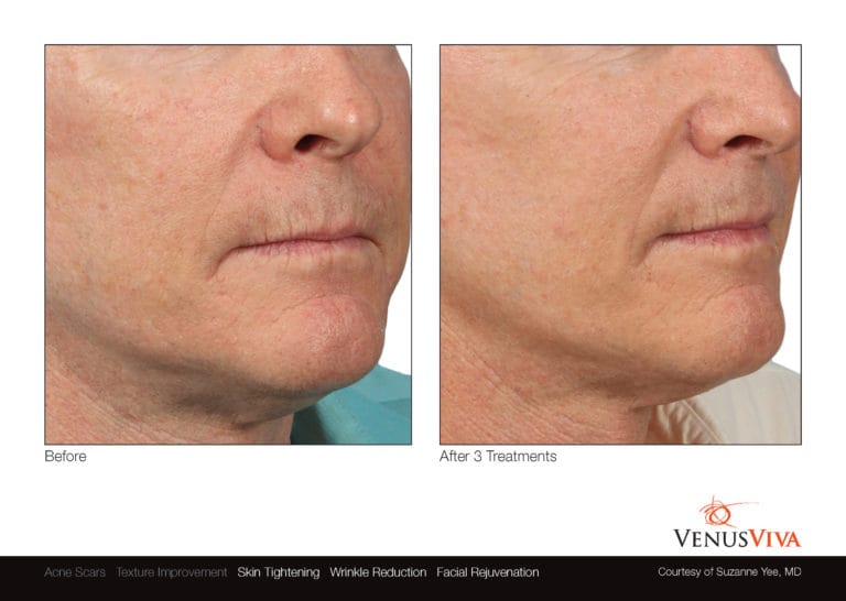 Venus Viva NYC