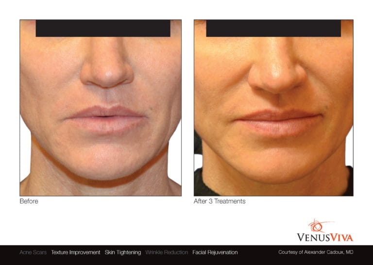 Venus Viva NYC