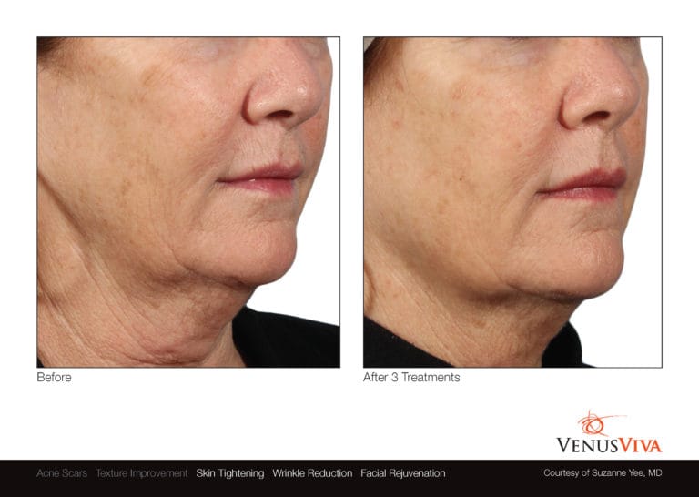 Venus Viva NYC