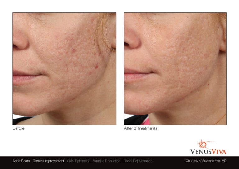Venus Viva NYC