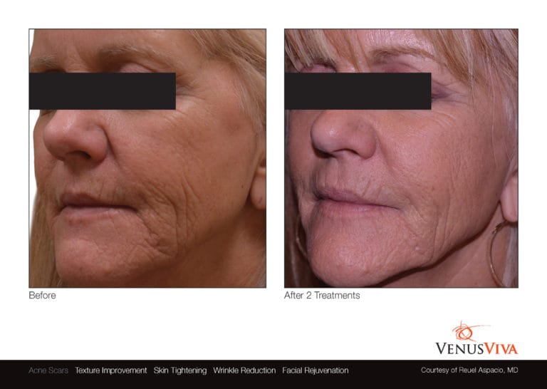 Venus Viva NYC